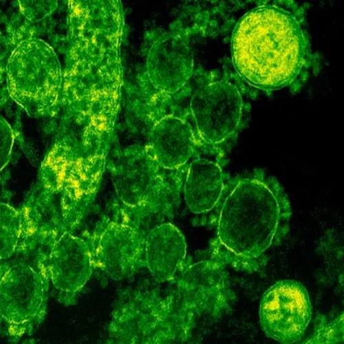A microscopic view of germs.