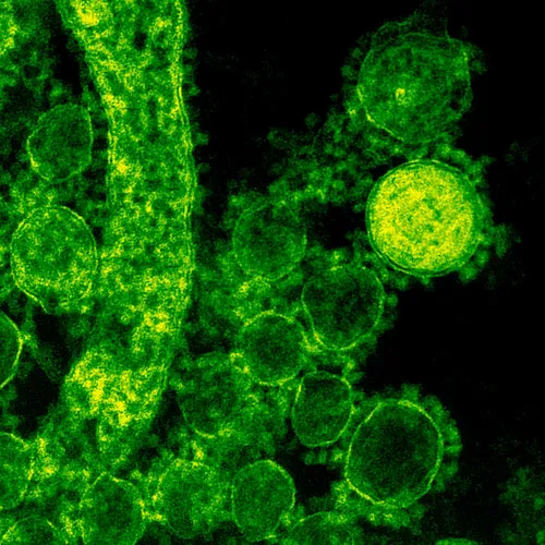 Bacteria Image